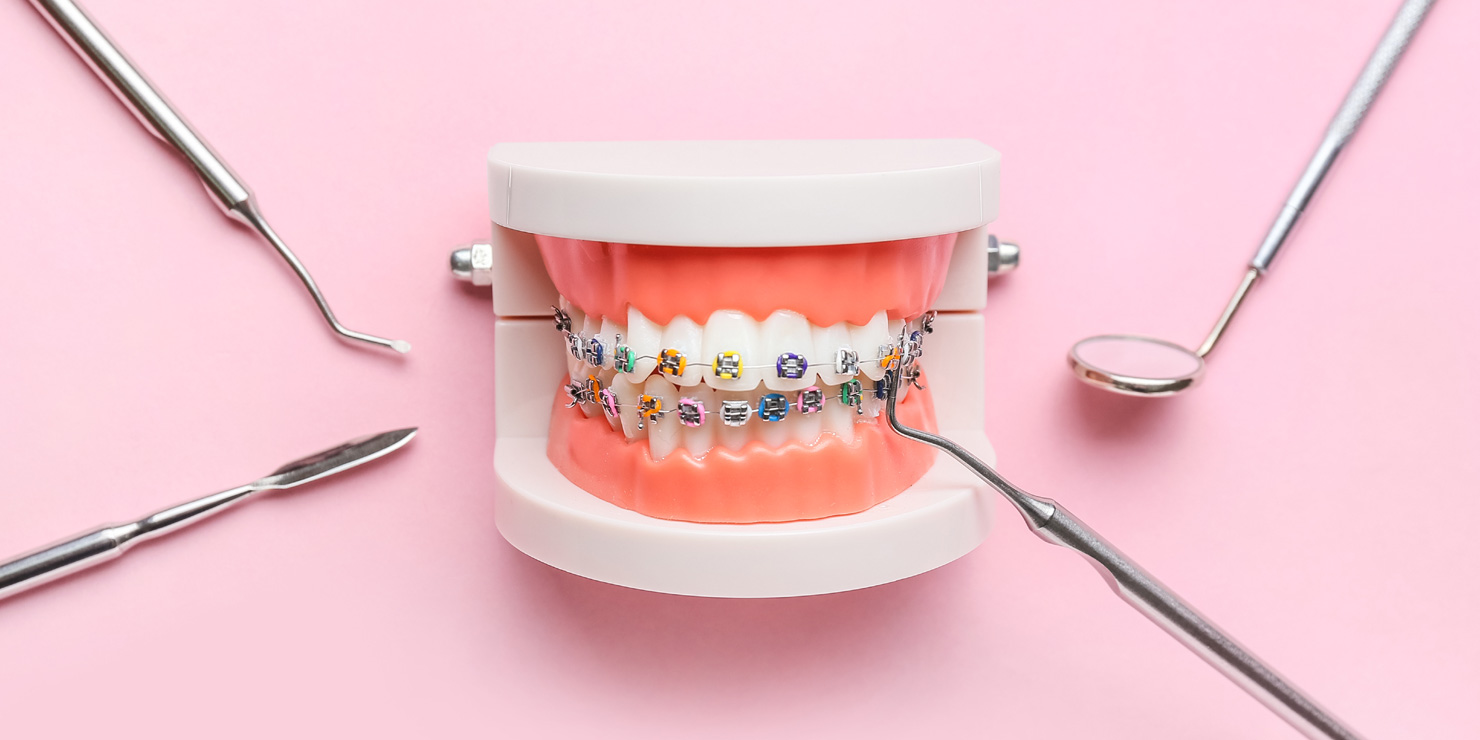 Model of jaw with dental braces and dentist tools