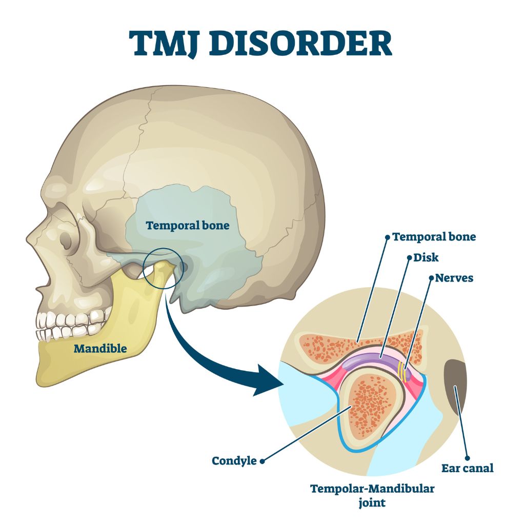 tmj description